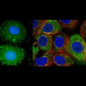 IF of MCF7 cells stained with DSHB antibody AFFN-HSPB8-13B6 against heat shock protein 8 (green). Image credit: DSHB.